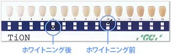 ホワイトニングの効果