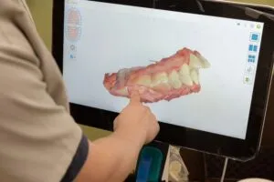 精密検査・型取り