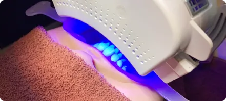 ホワイトニングの施術風景